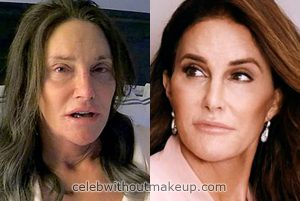 Caitlyn Jenner Before and After Makeup